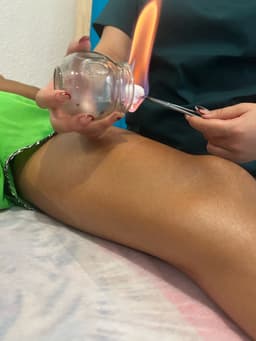 Terapia con Ventosas